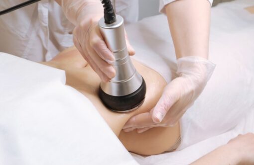 Radio-frequency body contouring treatment on a woman's abdomen for fat reduction and skin tightening.