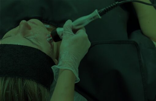 Advanced non-invasive skin tightening procedure with radiofrequency technology to improve skin elasticity and youthful appearance.