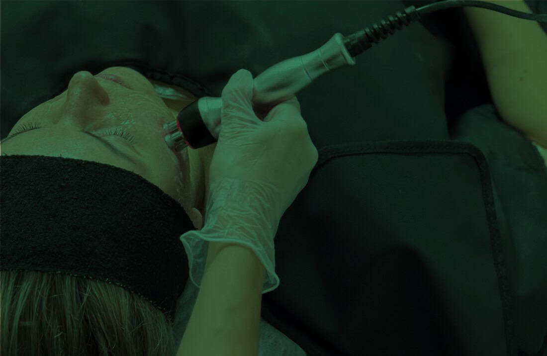 Advanced non-invasive skin tightening procedure with radiofrequency technology to improve skin elasticity and youthful appearance.