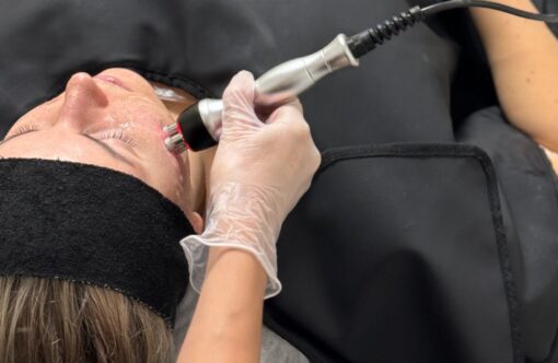 Non-invasive facial skin treatment using advanced skincare technology at SLIMM clinic.