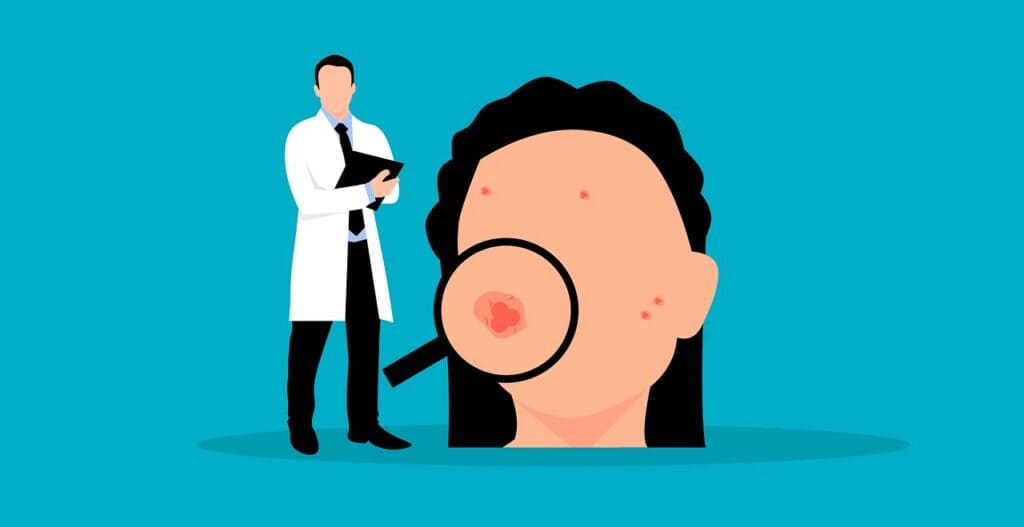 Acne skin examination with a healthcare professional, showing skin blemishes and pimples on the face, emphasizing acne treatment and dermatology services.